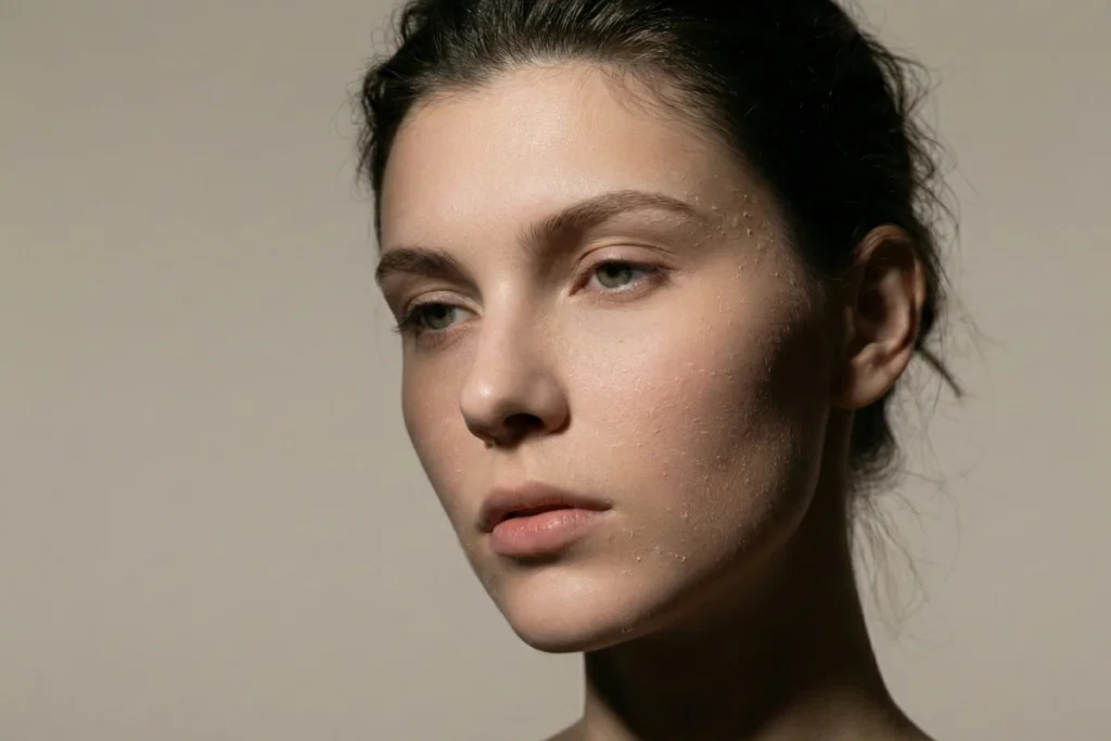 Rosto de mulher em close com textura de pele descamando e ressecada, exemplificando como saber meu tipo de pele quando ela apresenta sinais de secura.